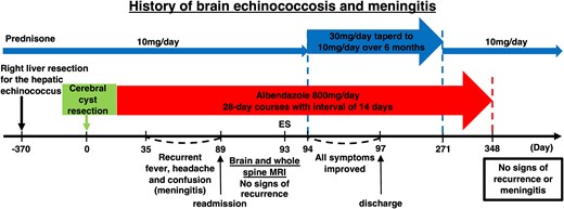 Schematic outline of the patient’s brain echinococcosis and meningitis history and sequence of treatments. ES = epileptic seizure. A flowchart of the patient’s clinical course showing the dose of prednisone on the top, the surgical procedure and the subsequent maintenance therapy in the middle, and the symptom timeline and test results on the bottom.