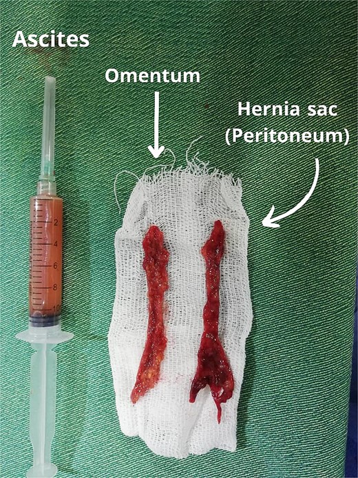 Shows the biopsies.