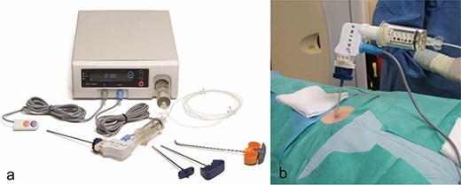 In a, image of the StabiliT® Vertebral Augmentation System (DFine Europe) with remote control, the cement applicator and the bone needles or osteotome (from left to right) as well as the control unit in the background. In (b), image of the connected application system.