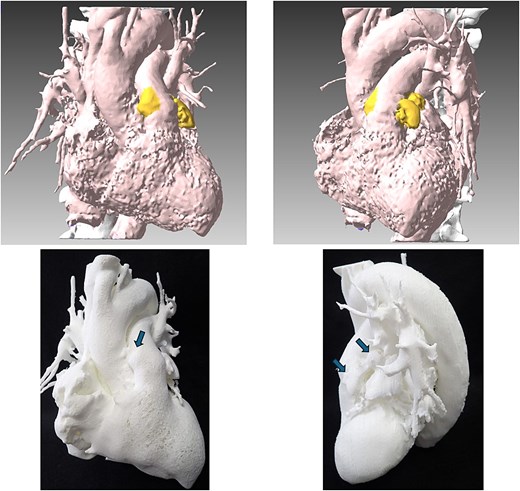 3D reconstructed images of the heart and 3D-printed anatomical structure.
