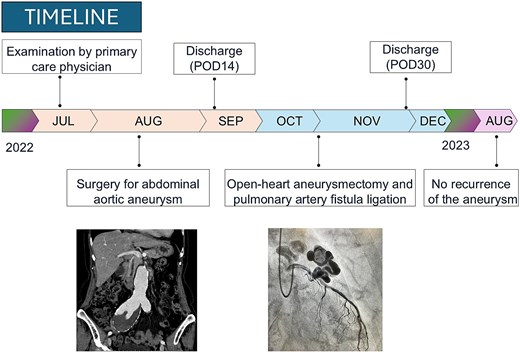 Timeline of the clinical course in the present case.