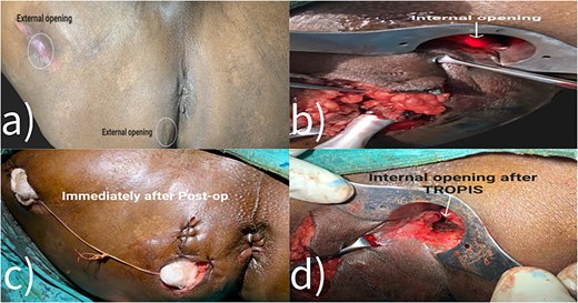 Intraoperative images.
