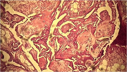 The cells exhibited no nuclear atypia.