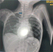 featured image