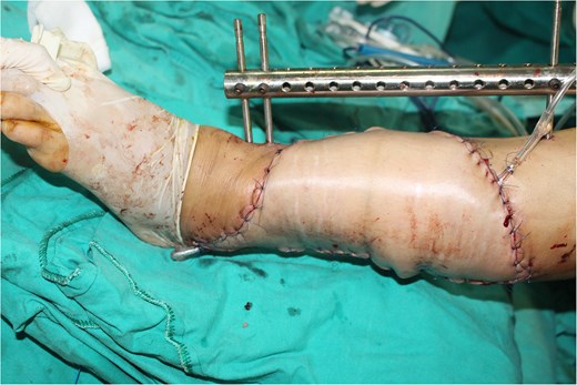 Intraoperative results.