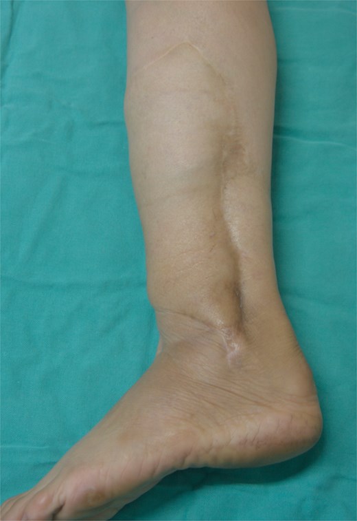 Lateral view.