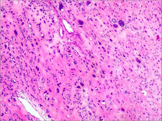 Intraoperative view demonstrating tumor adherence to the ileocolic artery.