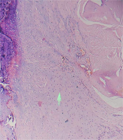 Hematoxylin and eosin (low power mode).