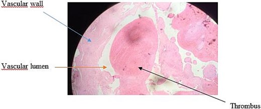 Histological image at intermediate magnification (×10).