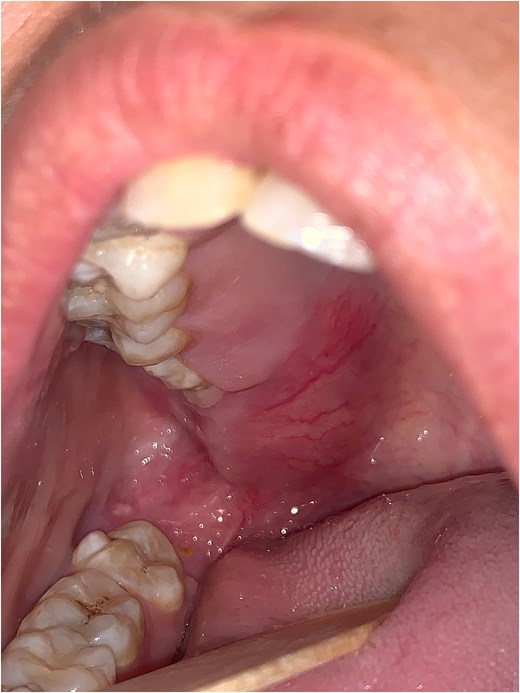 Clinical aspect of the tumor.