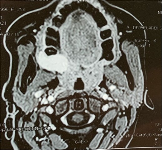 MRI findings.