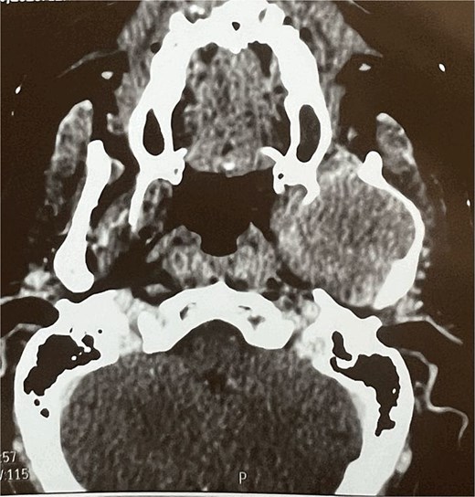 MRI findings.