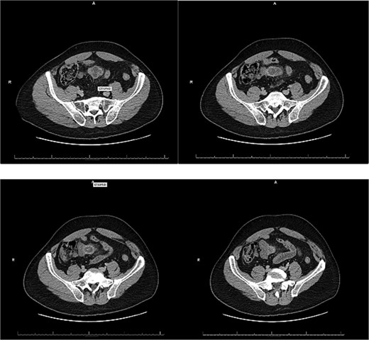 Representative slices of emergency department CT.