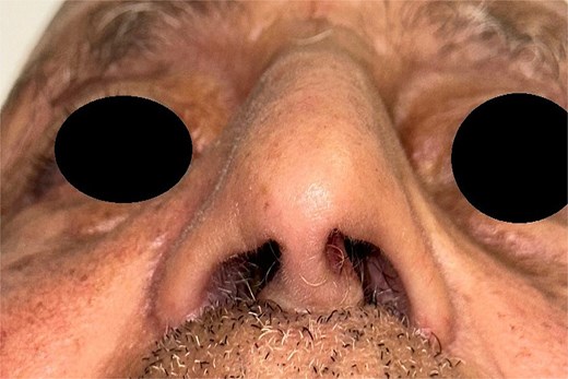 Postoperative image of the patient 1 month after surgery.