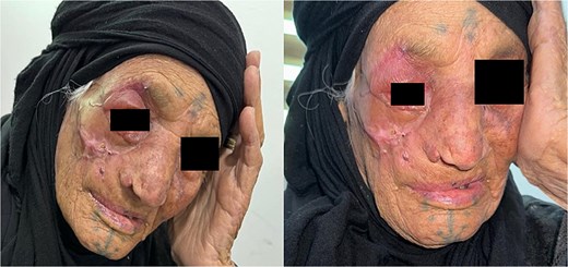 Postoperative photos showing the result after 1 year.