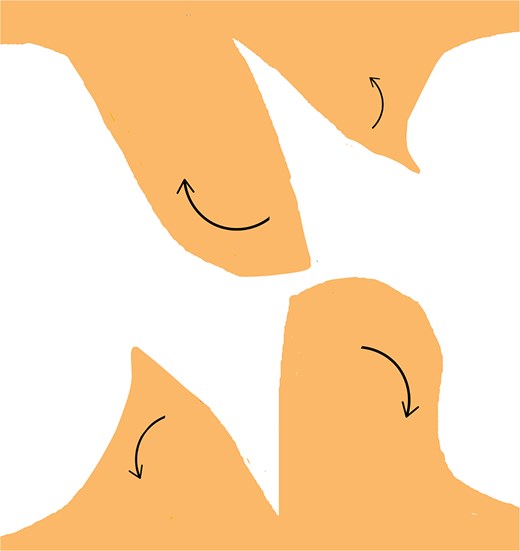 Retraction of the incised edges to widen the opening, creating adequate space for interlocking the contralateral flap without excessive tension.