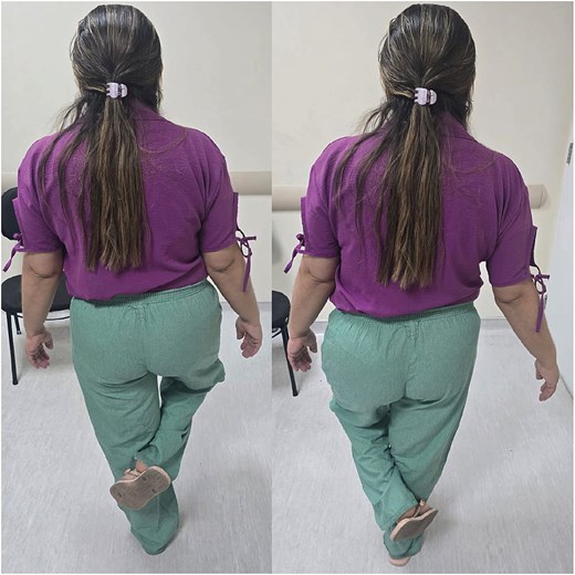 Postoperative after 12 months.