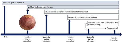 Clinical progression from congenital cutaneous manifestations to hospital admission. AVM (arteriovenous malformation), MRI (magnetic resonance imaging), MRA (magnetic resonance angiography), MRV (magnetic resonance venography), CT (computed tomography).