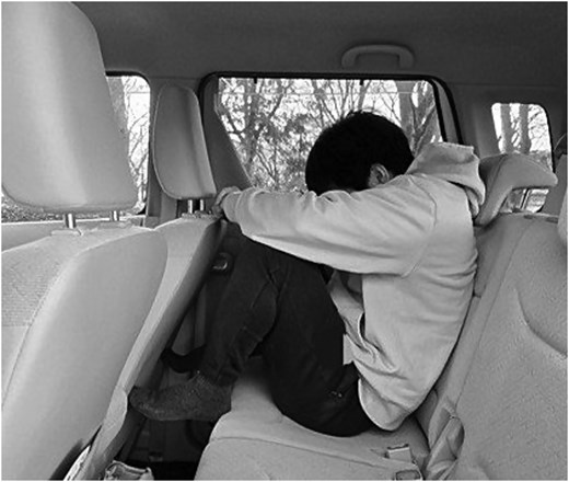 Simulated posture at the time of injury based on patient interview.