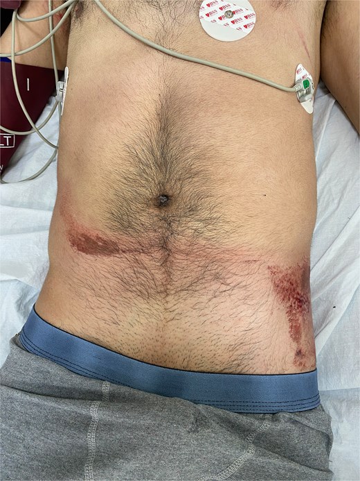 Seat belt sign on inspection.