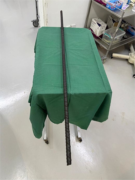 Intraoperative image showing the extracted metallic rod, measuring 1.5 m in length.
