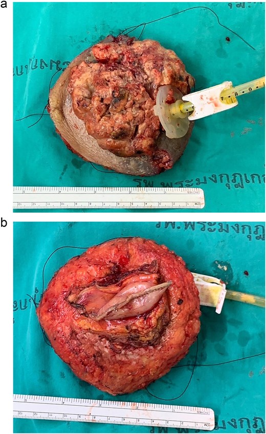 Gross specimen: (a) front, (b) back.