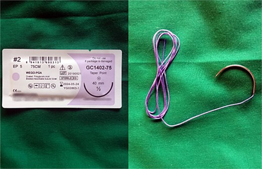 Shows the 40 mm round-bodied needle mounted to the Vicryl suture (both commercial name and country of manufacturing were blurred).