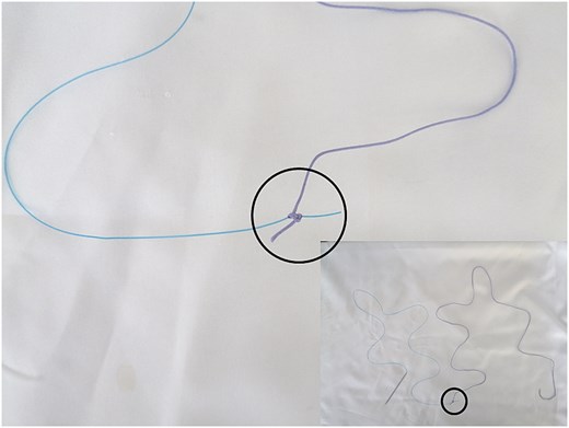 Illustrates how the free ends were tied (marked by the black circle).