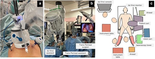 Field of view and positioning of the assistant. (a) da Vinci SP docked to access port with two assistant ports: 12 mm trocar on the left side and 5 mm trocar on the right side. (b) da Vinci SP with trans-perineal endoscopic approach, (c) Operation room set up and positioning.