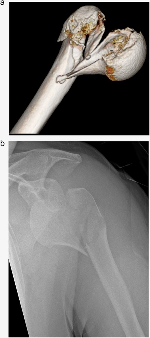 (a, b) Initial radiological findings.