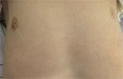 Image of the patient at 2 months post-operative.