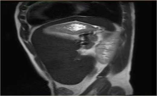 Imaging examination.