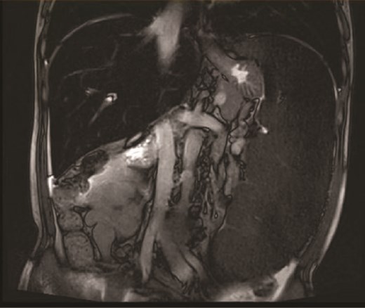 Imaging examination.