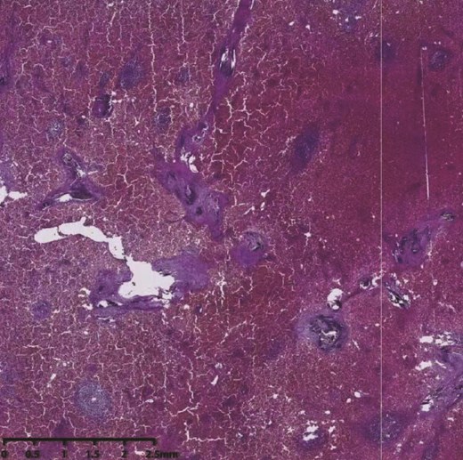 Histopathological section.