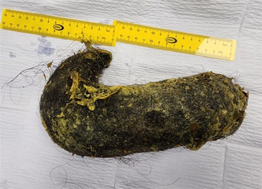 The extracted mass of hair and food particles.