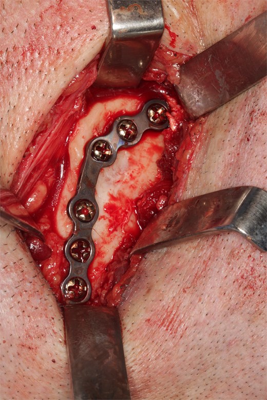 Initial orthopantomography