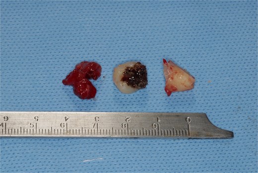 Cone bean CT