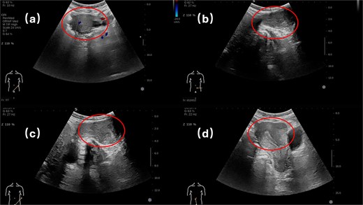 Superficial organ ultrasound and transvaginal ultrasound.
