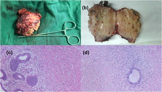 Postoperative gross pathology and HE staining.