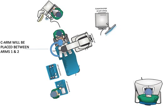 Diagram of set up in operating room.