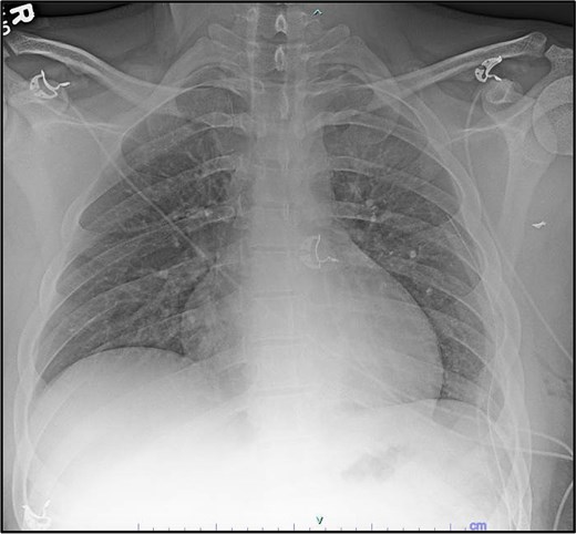 Postoperative imaging.