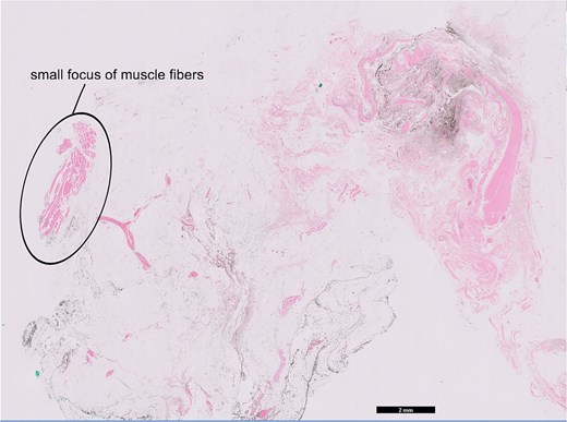 Hematoxylin and eosin slides.