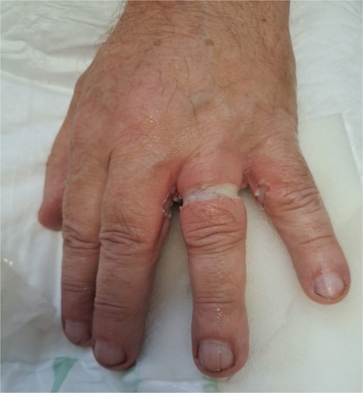 Dorsal view 90 min postinjury.