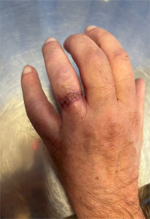 Dorsal aspect 3 months postsurgery.