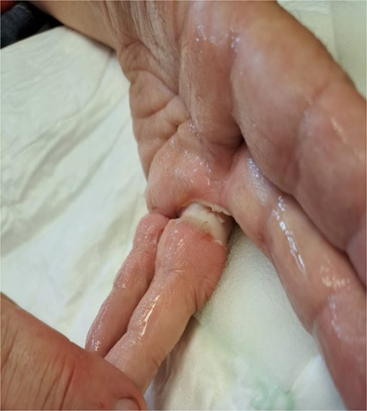 Radial view 90 min postinjury.