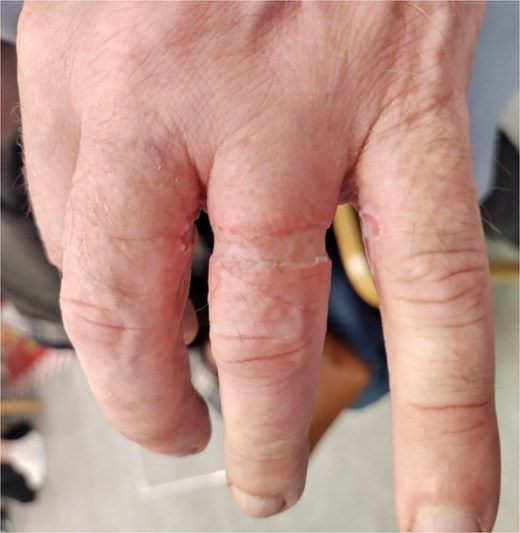 Dorsal view 4 h postinjury.