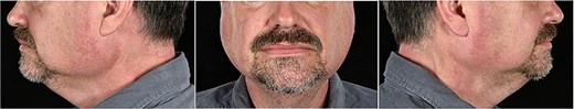 Photographs of frontal and side views of the patient before surgery.