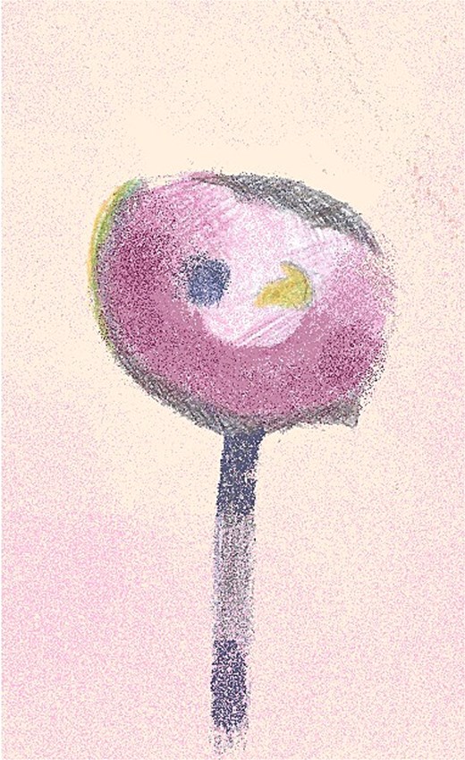 An illustration of left NAC necrosis as seen at Day 13 with adherent eschar and epidermolysis with central preservation of the nipple and surrounding areolar tissue.