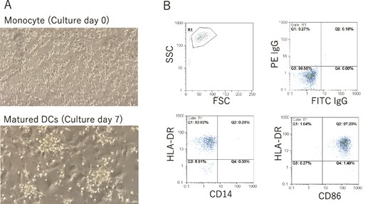 (A) Pictures of monocyte (culture Day 0) and matured DCs (culture Day 7) by light microscope. Magnification is 100×. (B) Surface markers of CD14, CD86, and HLA-DR of neoantigen-loaded DCs were investigated by FACS every time right before the administration. Administrated DCs showed CD14−CD86+HLA-DR+ phenotype.