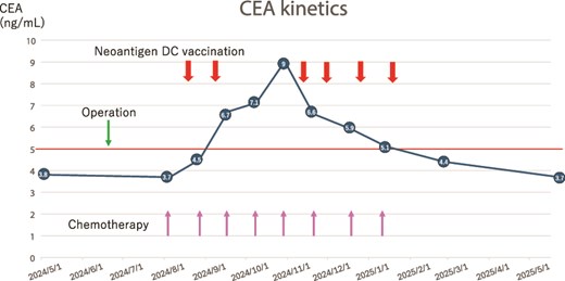 Therapy schedule and tumor marker kinetics. The thick arrows show neoantigen DC vaccine therapy. Thin arrows show oxaliplatin administration.